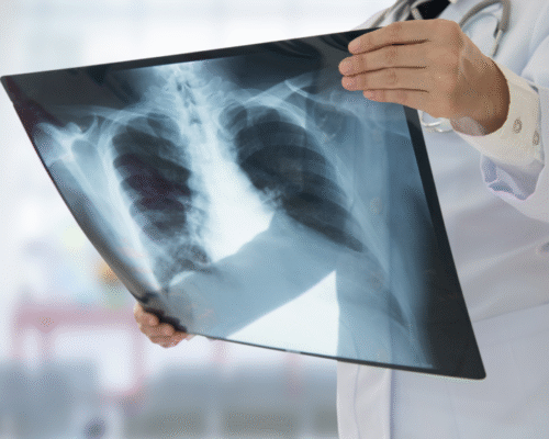 Allard-blog-02182022-e1644527281718